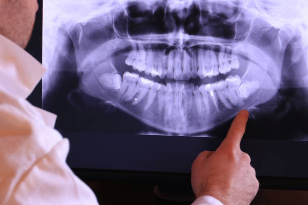 Best Dentist for Tooth Abscess  in San Marcos, TX